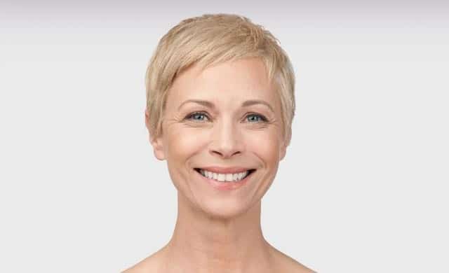 Botox for Women Before