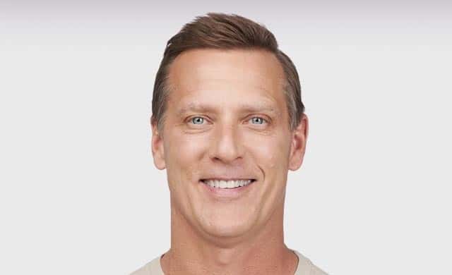 Botox for Men After