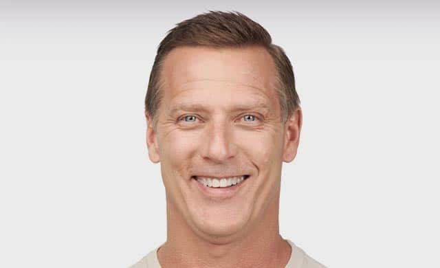 Botox for Men Before