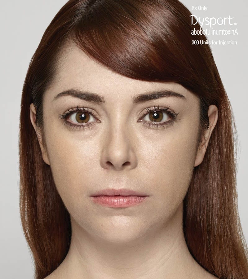 Dysport Ani Frown Line Treatment After