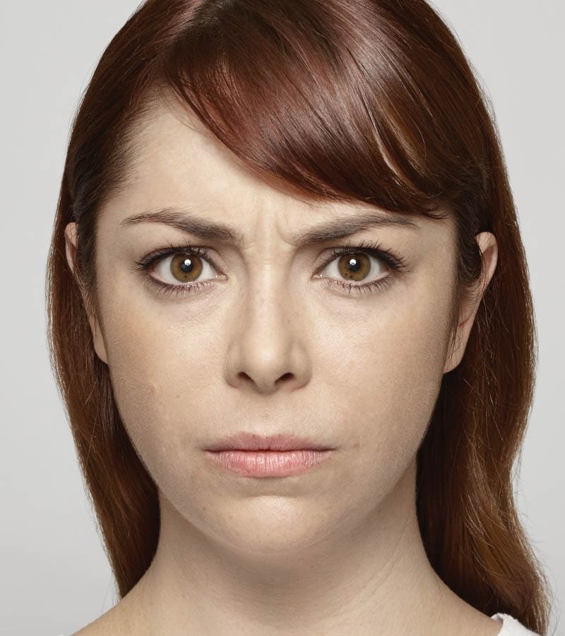 Dysport Ani Frown Line Treatment Before