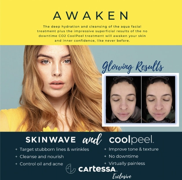skinwave-awaken-treatment SkinWave awaken in fort myers and naples, fl
