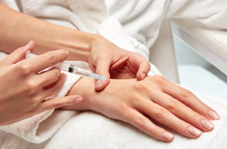 vampire-hand-lift-fort-myers-naples vampire hand lift in fort myers and naples, fl