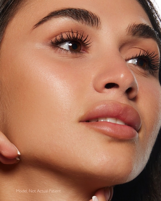 bellafill in fort myers and naples, fl