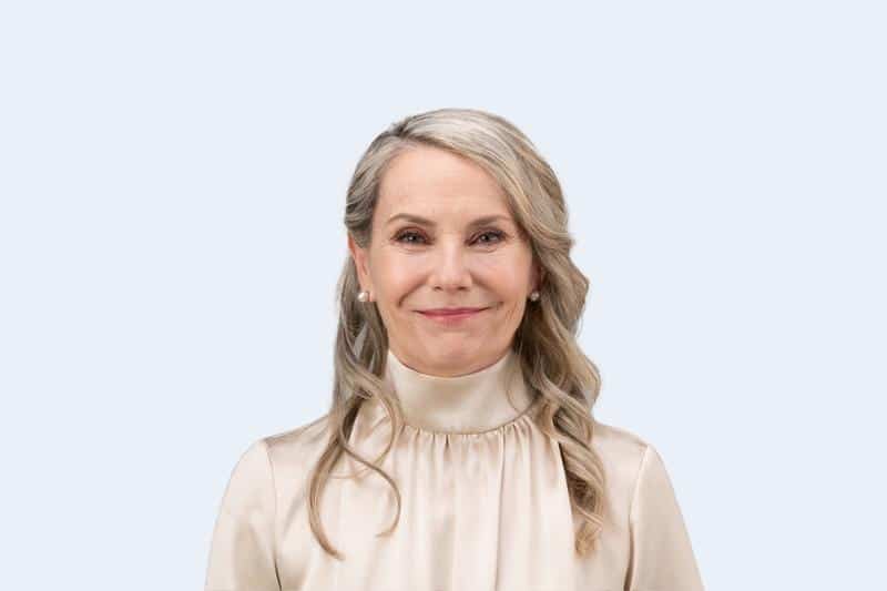The Before photo of a woman's before and after Redensity results